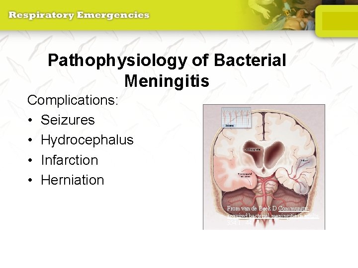 Pathophysiology of Bacterial Meningitis Complications: • Seizures • Hydrocephalus • Infarction • Herniation From