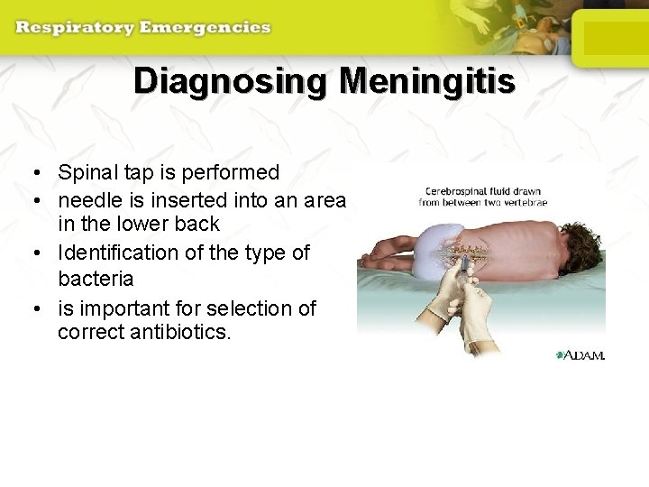 Diagnosing Meningitis • Spinal tap is performed • needle is inserted into an area