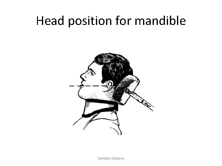 Head position for mandible Dentistry Explorer 