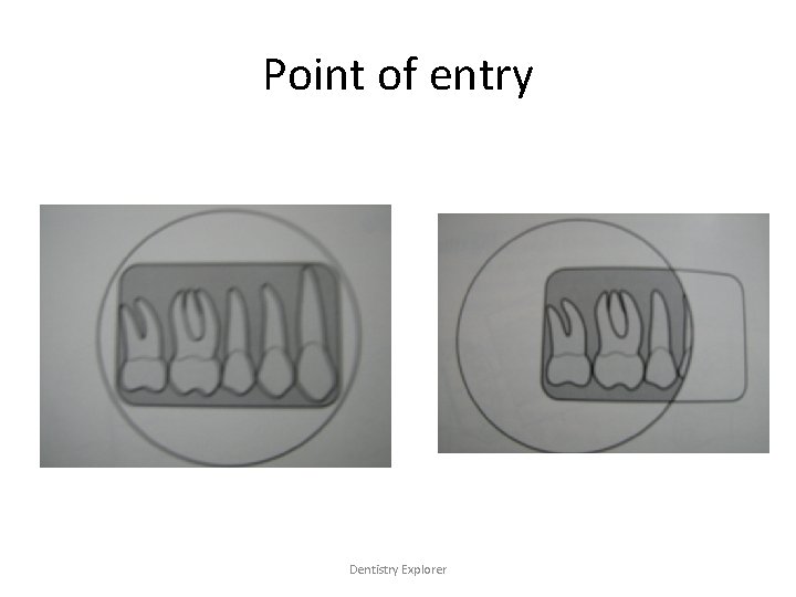 Point of entry Dentistry Explorer 