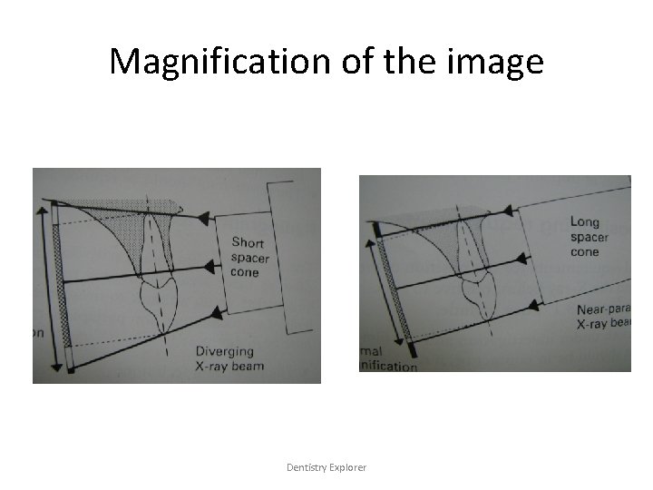 Magnification of the image Dentistry Explorer 