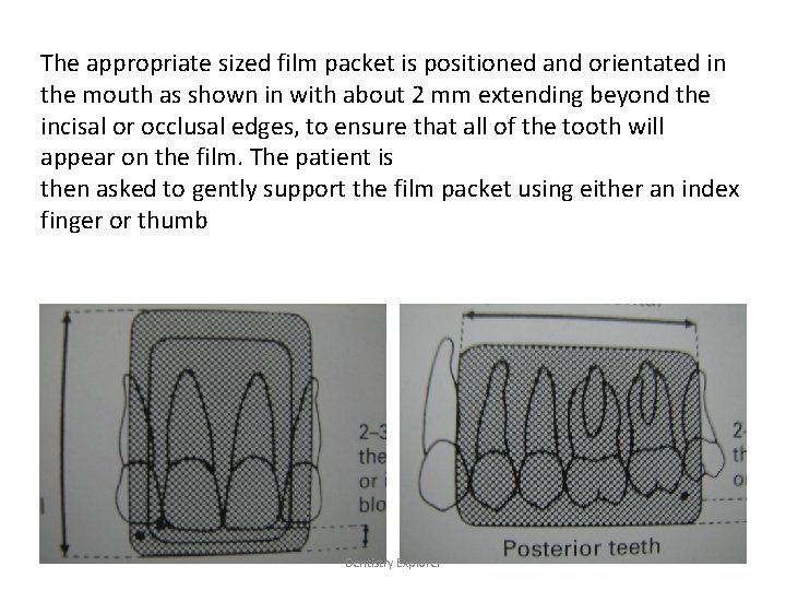 The appropriate sized film packet is positioned and orientated in the mouth as shown The appropriate sized film packet is positioned and orientated in the mouth as shown
