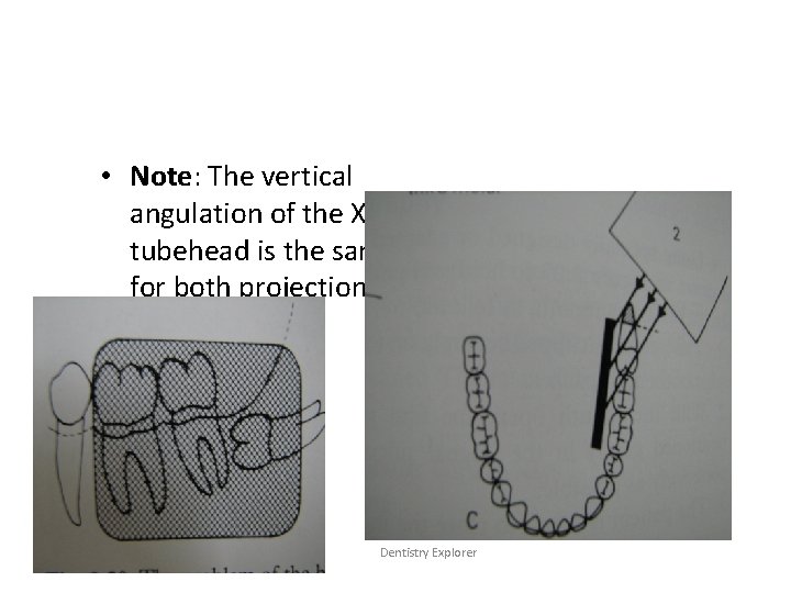 • Note: The vertical angulation of the X-ray tubehead is the same for • Note: The vertical angulation of the X-ray tubehead is the same for