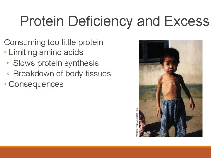 Protein Deficiency and Excess Consuming too little protein ◦ Limiting amino acids ◦ Slows