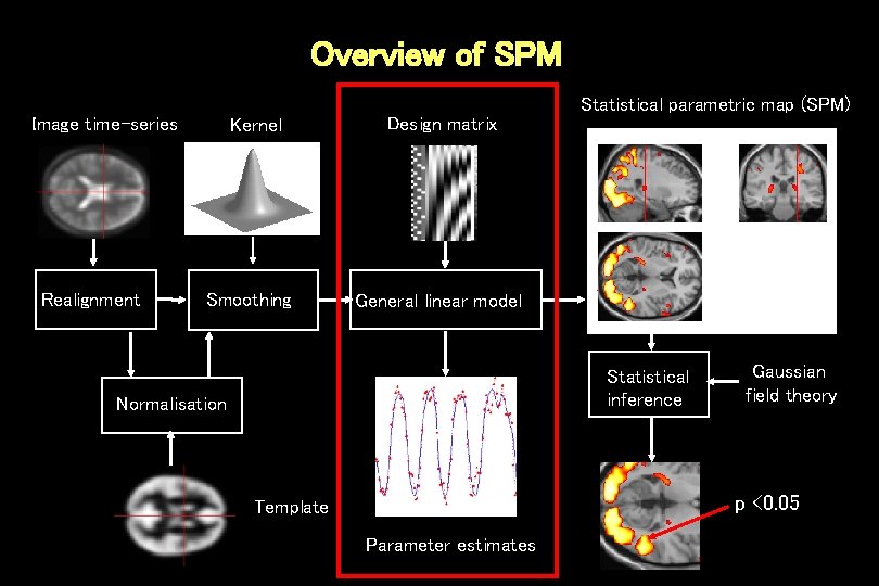 Overview of SPM Image time-series Realignment Kernel Smoothing Design matrix Statistical parametric map (SPM)