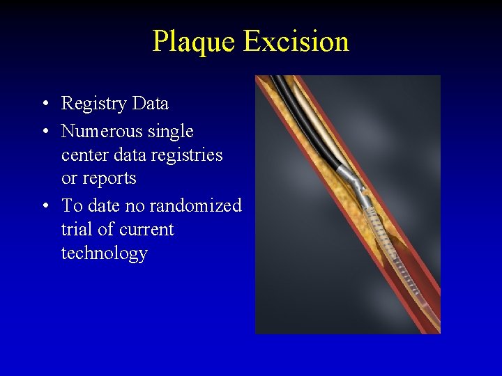 Plaque Excision • Registry Data • Numerous single center data registries or reports •