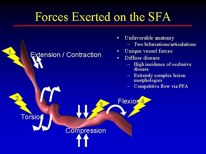 Forces Exerted on the SFA • Unfavorable anatomy – Two bifurcations/articulations 1. Extension /