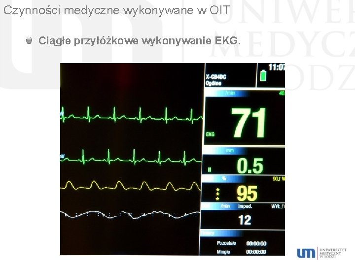 Czynności medyczne wykonywane w OIT Ciągłe przyłóżkowe wykonywanie EKG. 