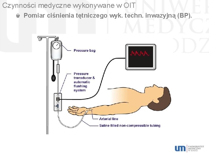 Czynności medyczne wykonywane w OIT Pomiar ciśnienia tętniczego wyk. techn. inwazyjną (BP). 