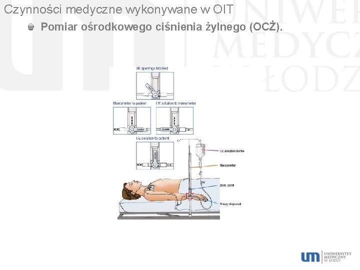 Czynności medyczne wykonywane w OIT Pomiar ośrodkowego ciśnienia żylnego (OCŻ). 