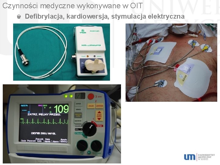 Czynności medyczne wykonywane w OIT Defibrylacja, kardiowersja, stymulacja elektryczna serca. 