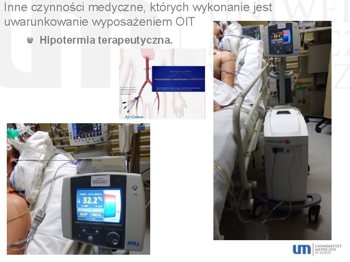 Inne czynności medyczne, których wykonanie jest uwarunkowanie wyposażeniem OIT Hipotermia terapeutyczna. 