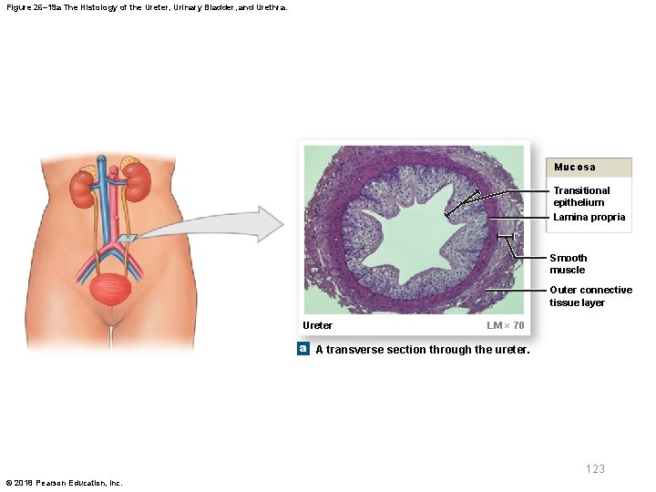 Figure 26– 19 a The Histology of the Ureter, Urinary Bladder, and Urethra. Mucosa