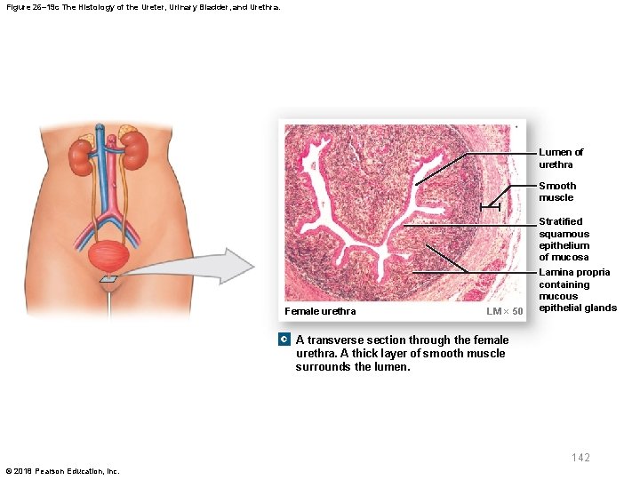 Figure 26– 19 c The Histology of the Ureter, Urinary Bladder, and Urethra. Lumen