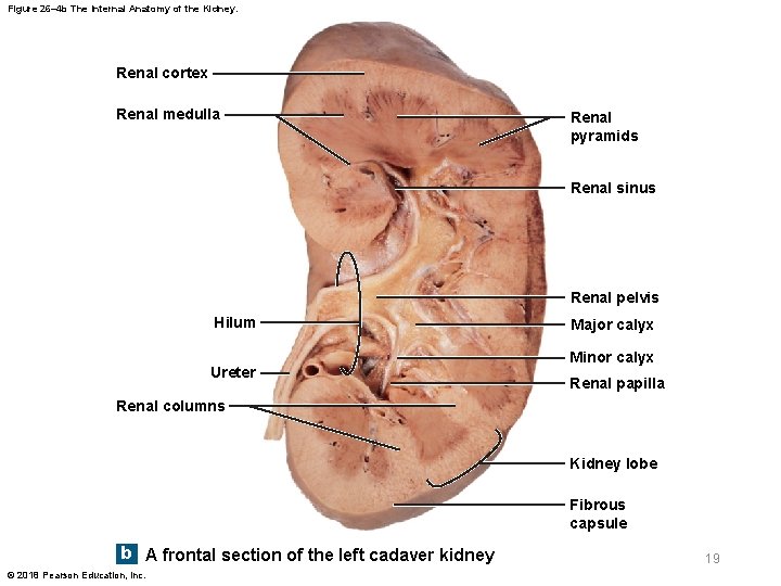 Figure 26– 4 b The Internal Anatomy of the Kidney. Renal cortex Renal medulla