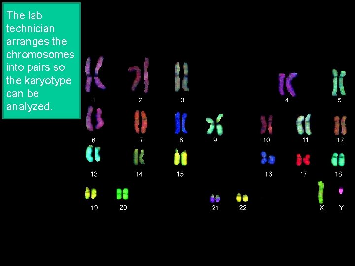 The lab technician arranges the chromosomes into pairs so the karyotype can be analyzed.
