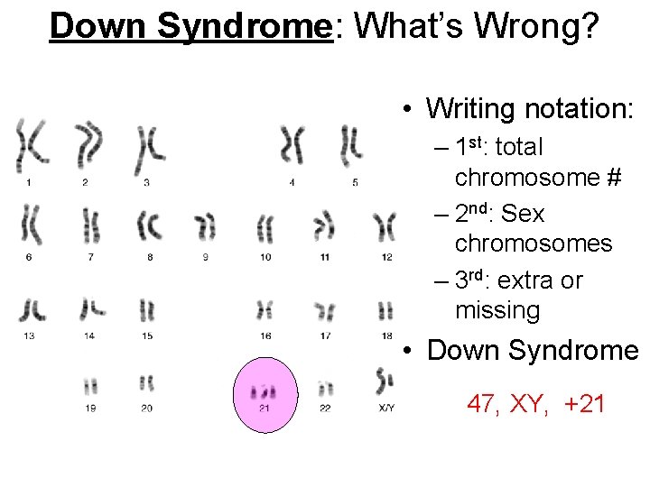 Down Syndrome: What’s Wrong? • Writing notation: – 1 st: total chromosome # –