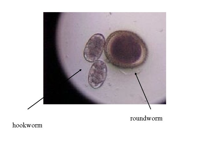 hookworm roundworm 