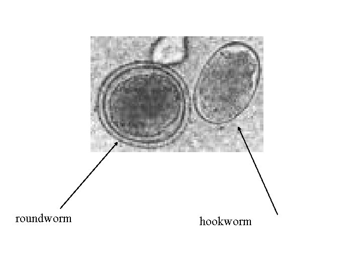 roundworm hookworm 