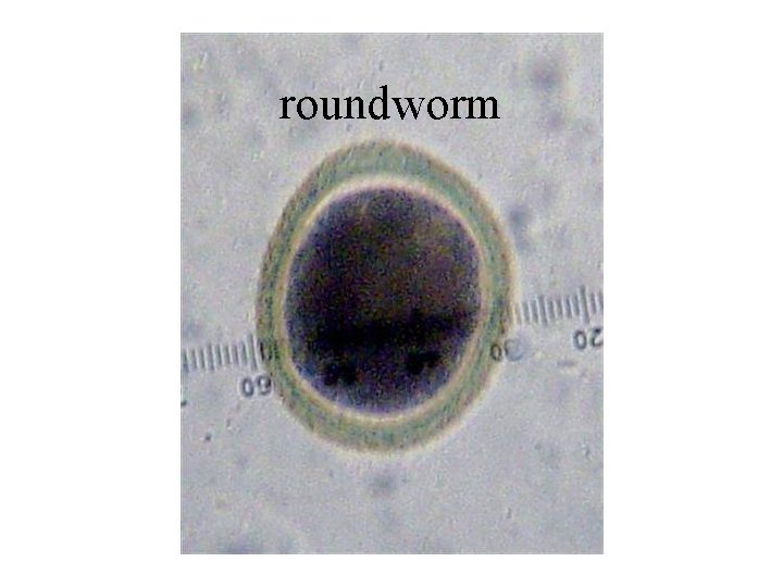 roundworm 
