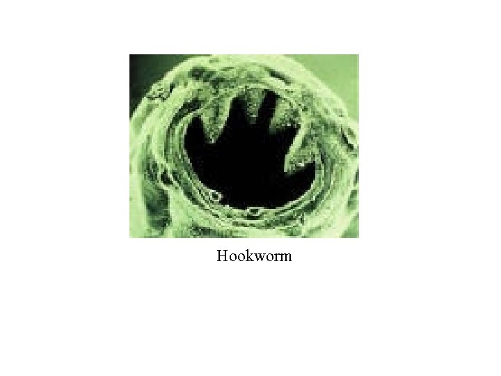 Hookworm 