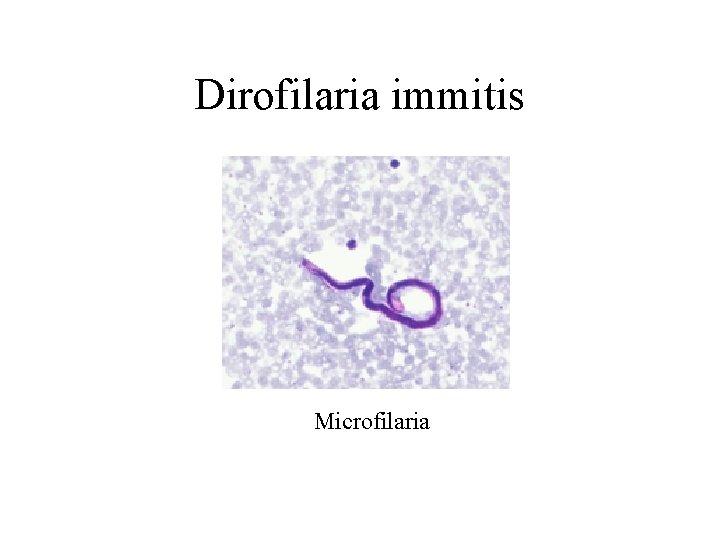 Dirofilaria immitis Microfilaria 