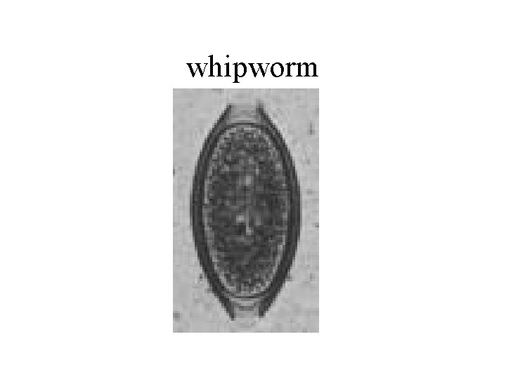 whipworm 