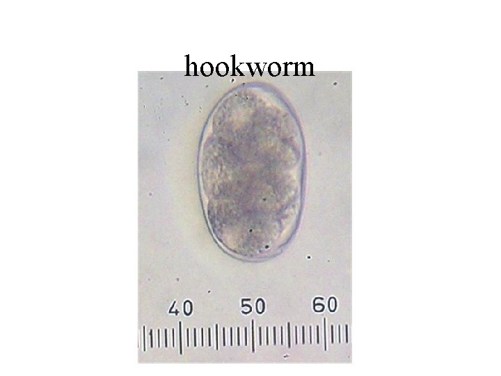 hookworm 