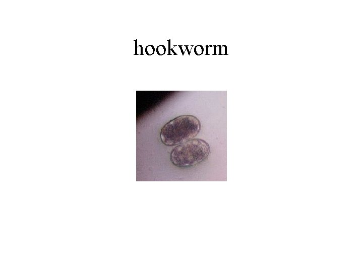 hookworm 