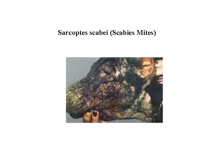 Sarcoptes scabei (Scabies Mites) 