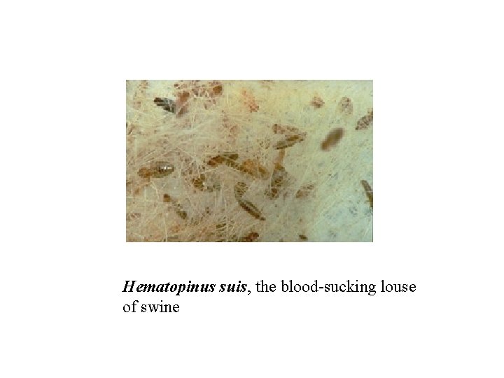 Hematopinus suis, the blood-sucking louse of swine 
