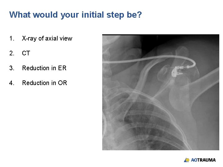 What would your initial step be? 1. X-ray of axial view 2. CT 3.