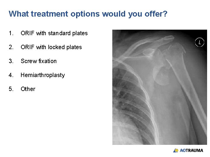 What treatment options would you offer? 1. ORIF with standard plates 2. ORIF with