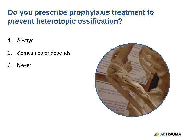 Do you prescribe prophylaxis treatment to prevent heterotopic ossification? 1. Always 2. Sometimes or