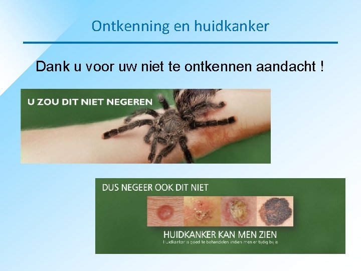 Ontkenning en huidkanker Dank u voor uw niet te ontkennen aandacht ! 