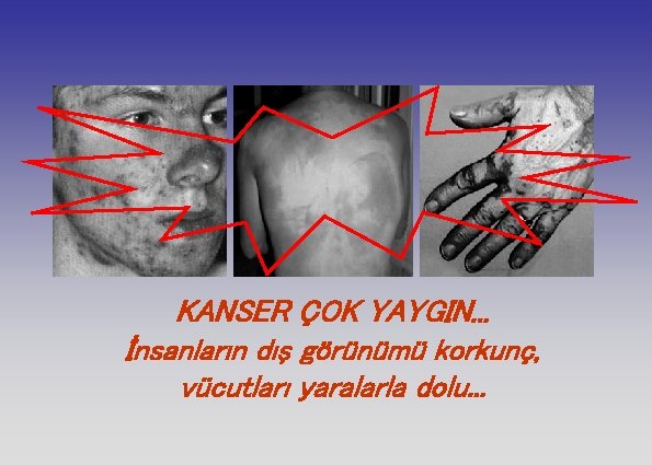 KANSER ÇOK YAYGIN. . . İnsanların dış görünümü korkunç, vücutları yaralarla dolu. . .