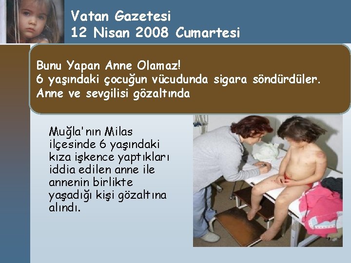 Vatan Gazetesi 12 Nisan 2008 Cumartesi Bunu Yapan Anne Olamaz! 6 yaşındaki çocuğun vücudunda