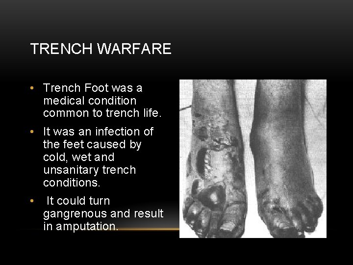 TRENCH WARFARE • Trench Foot was a medical condition common to trench life. •