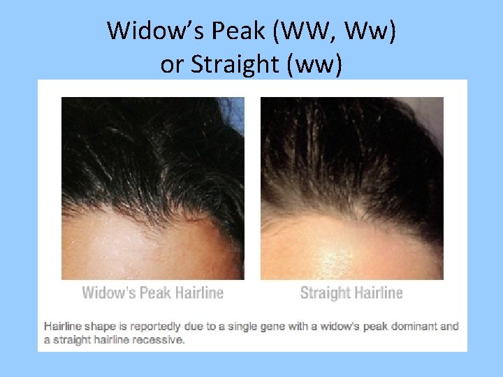 Widow’s Peak (WW, Ww) or Straight (ww) 