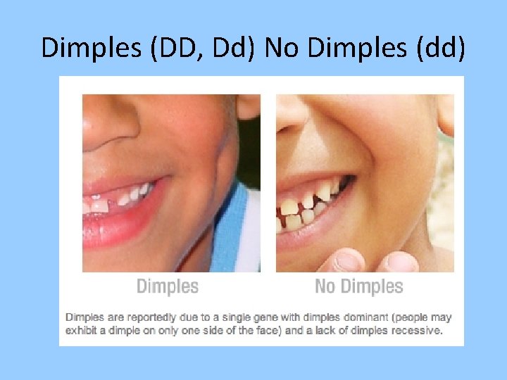 Dimples (DD, Dd) No Dimples (dd) 