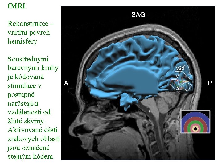 f. MRI Rekonstrukce – vnitřní povrch hemisféry Soustřednými barevnými kruhy je kódovaná stimulace v