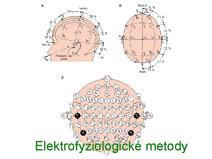 Elektrofyziologické metody 