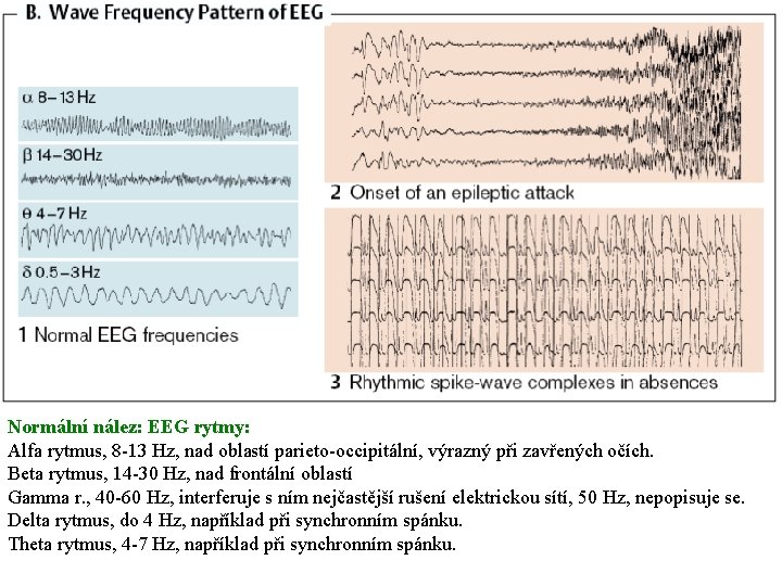 Normální nález: EEG rytmy: Alfa rytmus, 8 -13 Hz, nad oblastí parieto-occipitální, výrazný při