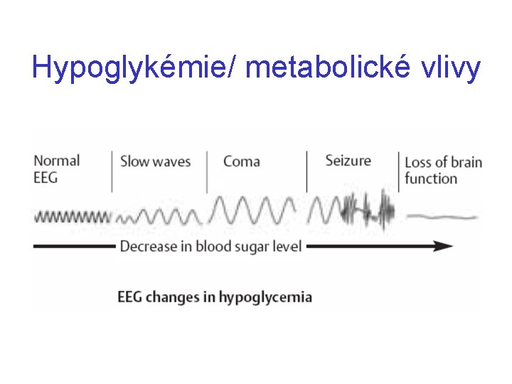 Hypoglykémie/ metabolické vlivy 