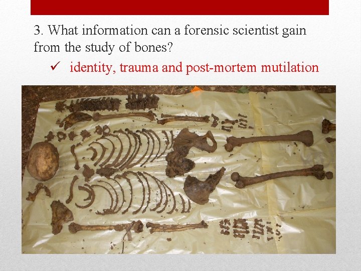 3. What information can a forensic scientist gain from the study of bones? ü