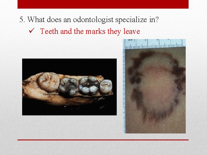 5. What does an odontologist specialize in? ü Teeth and the marks they leave
