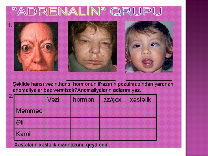 1. _________________ Şəkildə hansı vəzin, hansı hormonun ifrazının pozulmasından yaranan anomaliyalar baş vermisdir? Anomaliyalarin