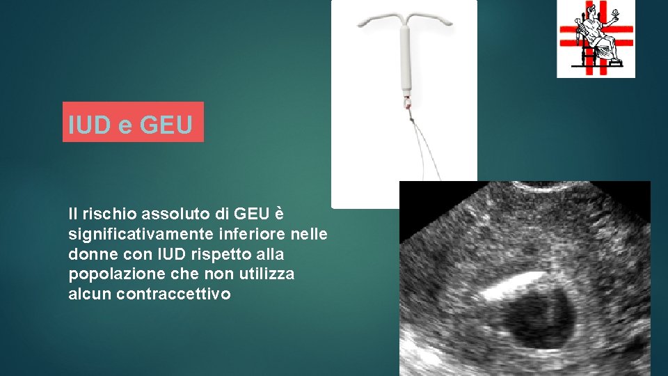 19 IUD e GEU Il rischio assoluto di GEU è significativamente inferiore nelle donne