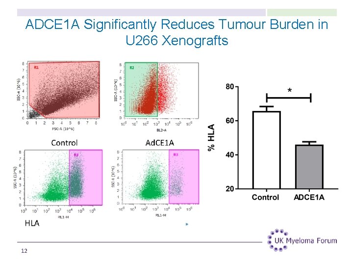 ADCE 1 A Significantly Reduces Tumour Burden in U 266 Xenografts 12 