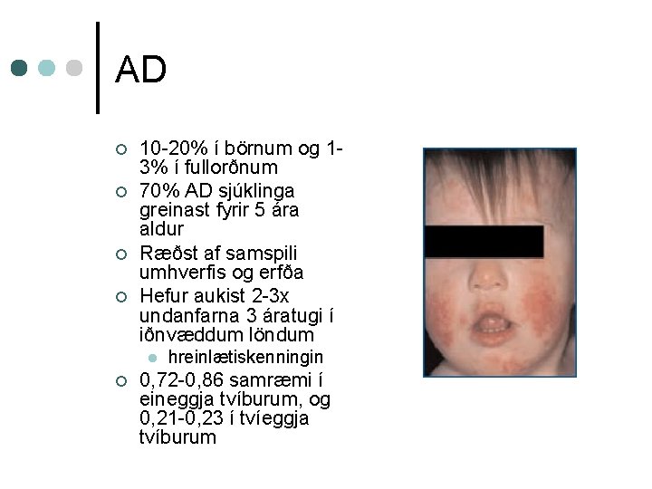 AD ¢ ¢ 10 -20% í börnum og 13% í fullorðnum 70% AD sjúklinga